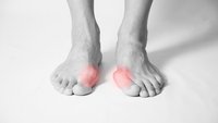 Was ist ein Hallux valgus und wie wird er behandelt?